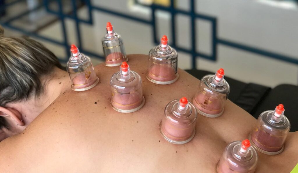 Unlocking Ancient Cupping Secrets