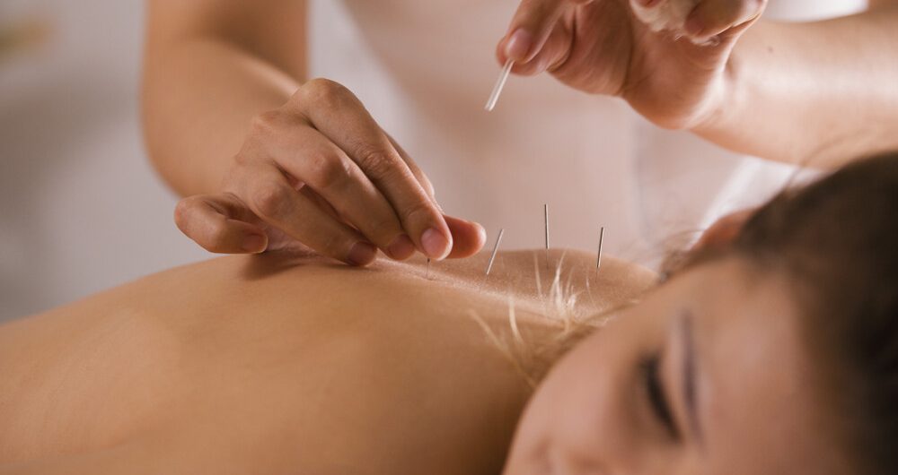 Unleashing Vitality: Acupuncture's Power